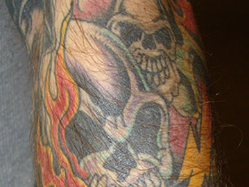 Flaming Skulls Arm Tattoo